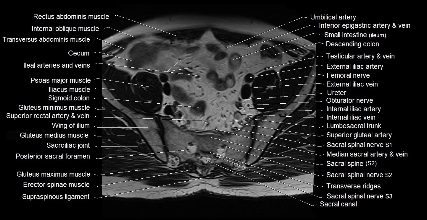 Male pelvis axial cross sectional anatomy image 7.webp
